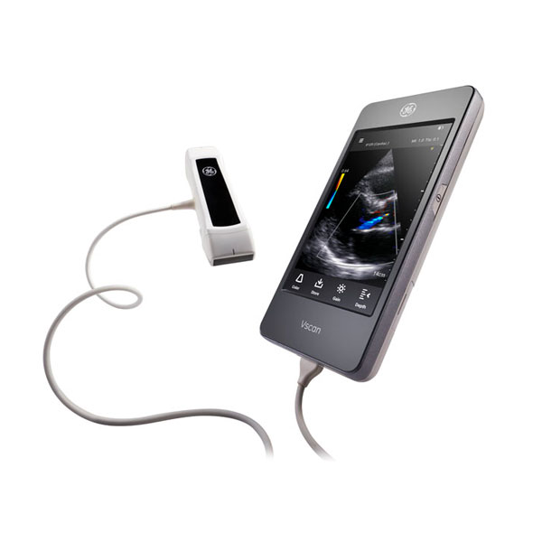Vscan Extend